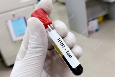 Casos de H1N1 crescem; diagnósticos de covid-19 caem