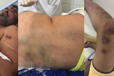 Dentista preso em Picos é encontrado com sinais de espancamento em delegacia