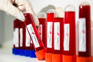 Piauí entra no 3º dia seguido sem registrar óbitos por covid-19