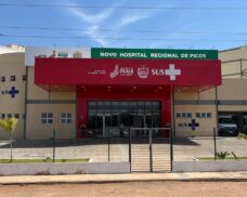 Hospital de Picos passa a contar com exame de ressonância